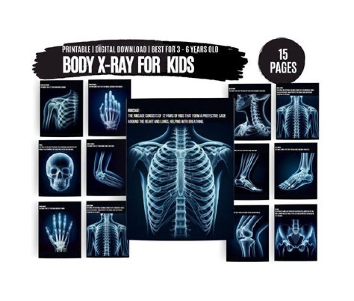 Keys In Human X-Ray