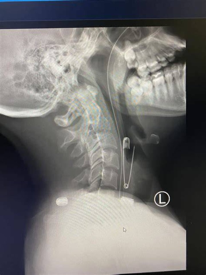 Safety Pin X-Ray