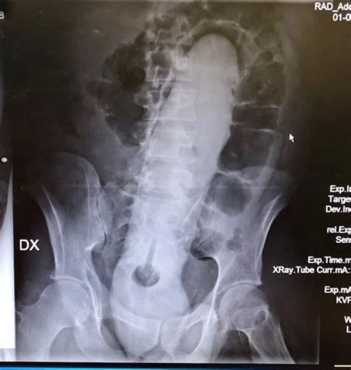 Weird X-Rays